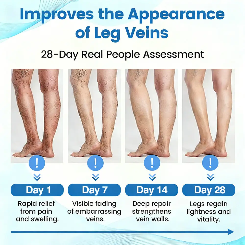 Seurico™ Advanced Vein Healing Spray