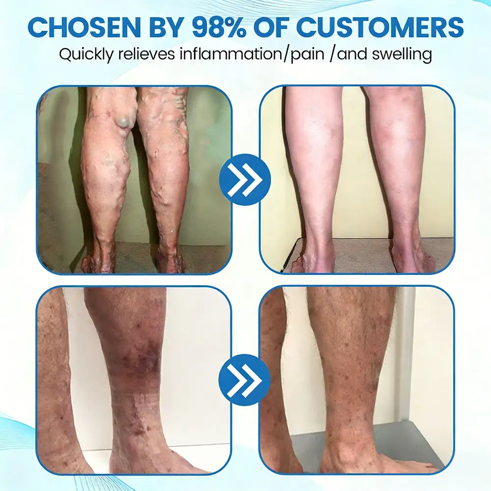 Seurico™ Advanced Vein Healing Spray