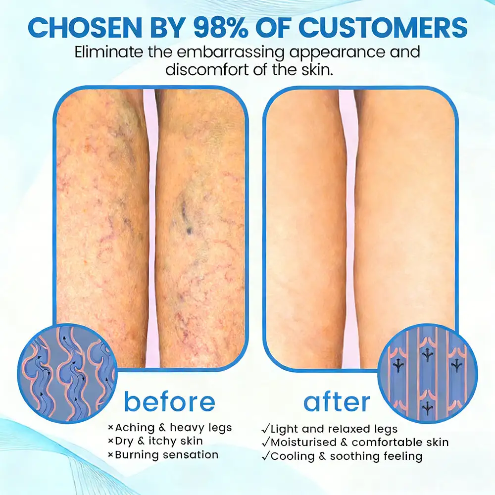 Seurico™ Advanced Vein Healing Spray
