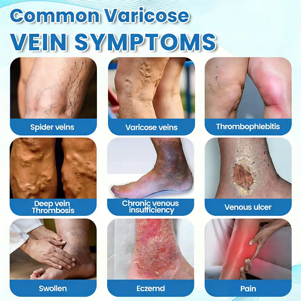 Seurico™ Advanced Vein Healing Spray